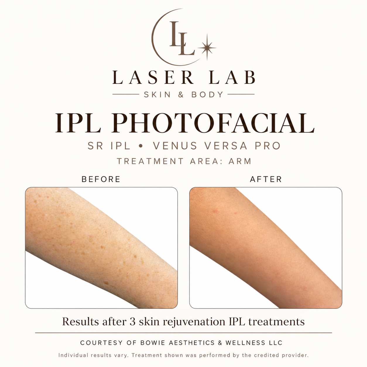The Photofacial before and after
